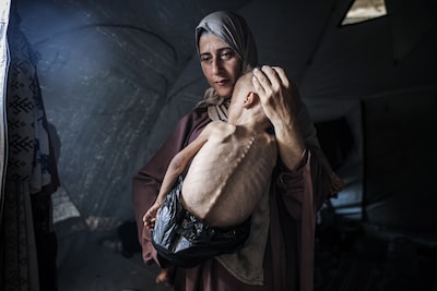 Muhammad (1) werd hét symbool van de hongersnood in Gaza, maar foto is nu onderdeel van controverse