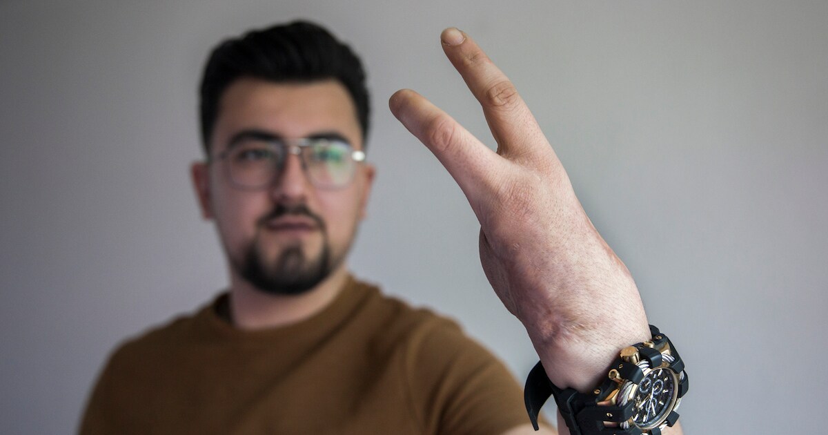 Een vlam, een knal en een harde piep: oude Cobra sloeg hand en leven ...