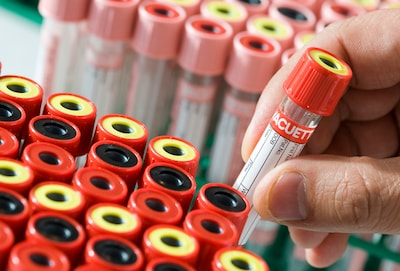 Sanquin zoekt 700 nieuwe bloeddonors in Zeeland